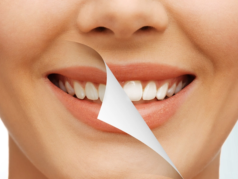 Top 5 Benefits of Choosing a Florida Dental Benefits Provider in Miami