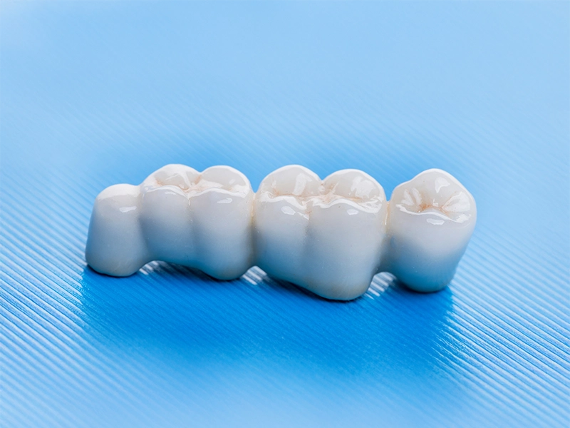 Cosmetic Dentistry Miami, Miami Teeth Whitening, Dental Veneers Miami FL, Best Cosmetic Dentist Miami, True Dentistry Plus Services, Dental Implants Miami, Permanent Tooth Replacement Miami, True Dentistry Plus Dental Implants, Best Implant Dentist in Miami, Miami Dental Implant Services, Dentures Miami, Custom Dentures Miami FL, Full Dentures Miami, Partial Dentures Miami, True Dentistry Plus Dentures, Gum Contouring Miami, Miami Gum Reshaping, Cosmetic Gum Surgery Miami FL, True Dentistry Plus Gum Contouring, Smile Enhancement Miami, Porcelain Crowns Miami, Durable Dental Crowns Miami FL, True Dentistry Plus Crowns, Cosmetic Dental Crowns Miami, Natural-Looking Crowns Miami, Smile Makeover Miami, True Dentistry Plus Smile Enhancement, Miami Smile Design, Full Smile Restoration Miami, Professional Teeth Bleaching Miami, True Dentistry Plus Whitening Services, Miami Cosmetic Teeth Whitening, Best Teeth Whitening Miami FL, Porcelain Veneers Miami FL, True Dentistry Plus Veneers, Cosmetic Veneers Miami, Best Veneers Dentist in Miami, Emergency Dentist Miami, 24/7 Dental Care Miami FL, Urgent Dental Care Miami, True Dentistry Plus Emergency Services, Miami Emergency Dental Services, Miami Dentist, Dental Care Miami FL, Family Dentistry Miami, Dental Health Blog Miami, True Dentistry Plus Blog, Miami Dental Care Tips, Dental News Miami FL, Oral Health Insights Miami, Contact True Dentistry Plus, Miami Dentist Contact, Schedule Dental Appointment Miami, Dental Office Location Miami, True Dentistry Plus Phone Number, Dental Deals Miami, True Dentistry Plus Specials, Miami Dental Offers, Teeth Whitening Discounts Miami, Invisalign Promotion Miami, Oral Surgery Miami, Wisdom Tooth Extraction Miami FL, True Dentistry Plus Oral Surgeons, Miami Oral Surgery Clinic, Tooth Extractions Miami, Bone Grafting Miami FL, Dental Surgery Miami, True Dentistry Plus Extractions, Miami Bone Graft Procedures, LANAP Miami, Laser Gum Therapy Miami FL, Minimally Invasive Gum Treatment Miami, True Dentistry Plus LANAP, Gum Disease Treatment Miami, Sinus Lift Surgery Miami, Dental Implant Preparation Miami, True Dentistry Plus Sinus Lift, Sinus Augmentation Miami, Wisdom Tooth Extractions Miami, Remove Wisdom Teeth Miami FL, Oral Surgery for Wisdom Teeth Miami, Miami Wisdom Teeth Removal, Orthodontics Miami, Braces Miami FL, Invisalign Miami, True Dentistry Plus Orthodontics, Teeth Straightening Miami, Clear Aligners Miami FL, True Dentistry Plus Invisalign, Invisalign Dentist Miami, Invisible Braces Miami, Preventive Dentistry Miami, Dental Cleanings Miami FL, Oral Exams Miami, True Dentistry Plus Preventive Care, Miami Dental Checkups, Comprehensive Dental Exams Miami, Full Oral Exam Miami FL, Dental Checkup Miami, True Dentistry Plus Exams, Dental Hygiene Miami, Teeth Cleaning Miami FL, Oral Hygiene Services Miami, True Dentistry Plus Dental Cleanings, Preventive Dental Care Miami, Nightguards Miami, Custom Mouthguards Miami FL, Teeth Grinding Protection Miami, Bruxism Treatment Miami, True Dentistry Plus Nightguards, Oral Cancer Screening Miami, Early Detection Oral Cancer Miami FL, Oral Health Screening Miami, True Dentistry Plus Screenings, Periodontics Miami, Deep Cleaning Dentist Miami, True Dentistry Plus Periodontics, Scaling and Root Planing Miami, Sleep Apnea Therapy Miami, Snoring Treatment Miami FL, Sleep Apnea Dentist Miami, Oral Appliance Therapy Miami, True Dentistry Plus Sleep Solutions, TMJ Treatment Miami, TMD Therapy Miami FL, Jaw Pain Relief Miami, True Dentistry Plus TMJ Specialist, TMJ Dentist Miami, Restorative Dentistry Miami, Dental Crowns and Bridges Miami FL, Tooth Repair Miami, True Dentistry Plus Restorations, Dental Bridges Miami, Replace Missing Teeth Miami FL, Tooth Bridge Miami, True Dentistry Plus Dental Bridges, Fixed Dental Bridge Miami, Dental Fillings Miami, Cavity Treatment Miami FL, Tooth Fillings Miami, Composite Fillings Miami, True Dentistry Plus Fillings, Smile Restoration Miami FL, Complete Dental Makeover Miami, True Dentistry Plus Reconstruction, Rebuild Smile Miami, Full-Arch Dental Implants Miami, All-on-4 Implants Miami FL, Full Mouth Implants Miami, True Dentistry Plus Implants, Root Canal Miami, Endodontic Treatment Miami FL, Tooth Pain Relief Miami, True Dentistry Plus Root Canal, Save Infected Tooth Miami
