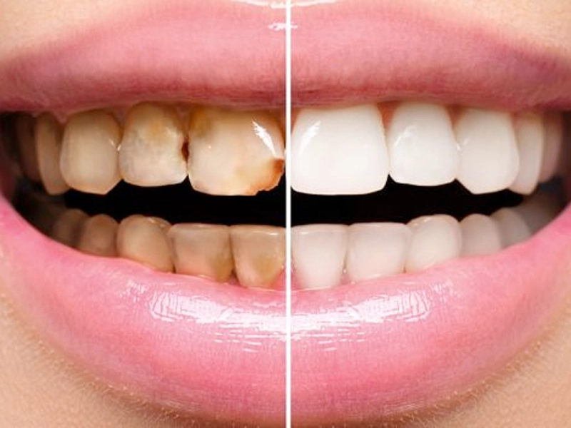 From Concept to Confidence: What a Dental Design Studio Can Do for Your Smile